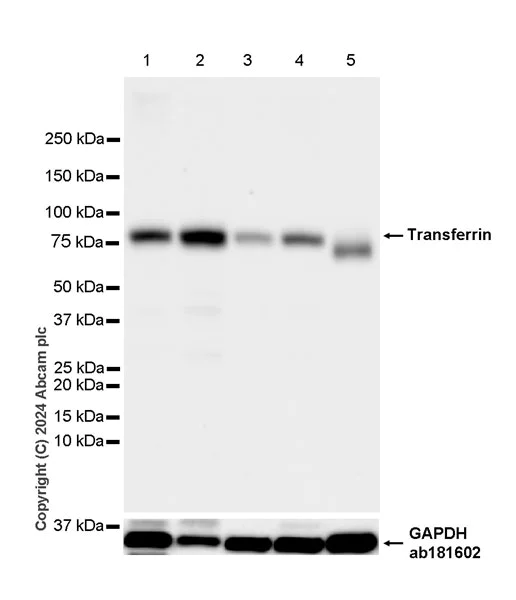 Western blot - Anti-Transferrin antibody [RM2060] - BSA and Azide free (AB318998)