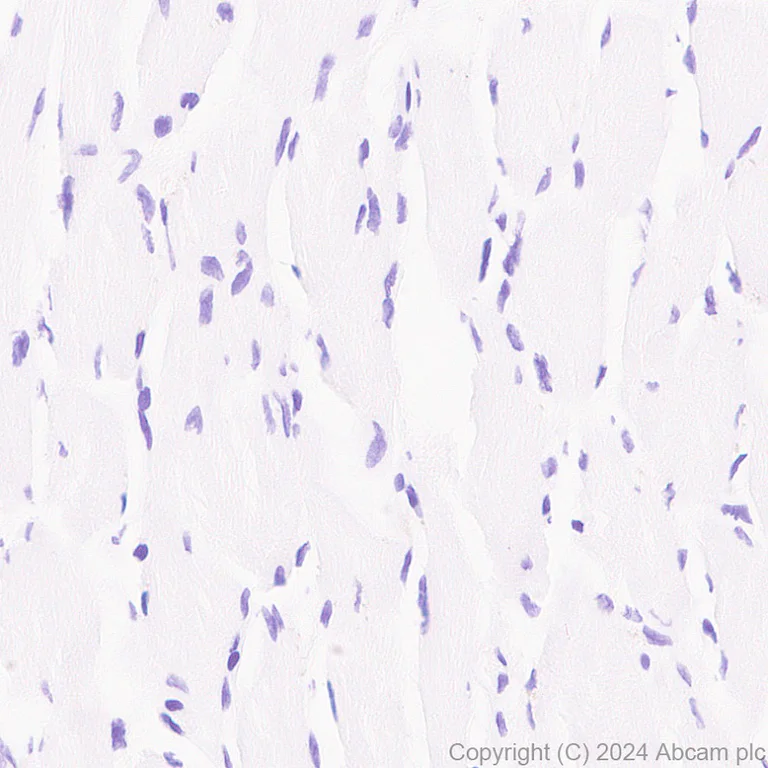 Immunohistochemistry (Formalin/PFA-fixed paraffin-embedded sections) - Anti-Transferrin antibody [RM2060] - Serum Loading Control (AB318997)