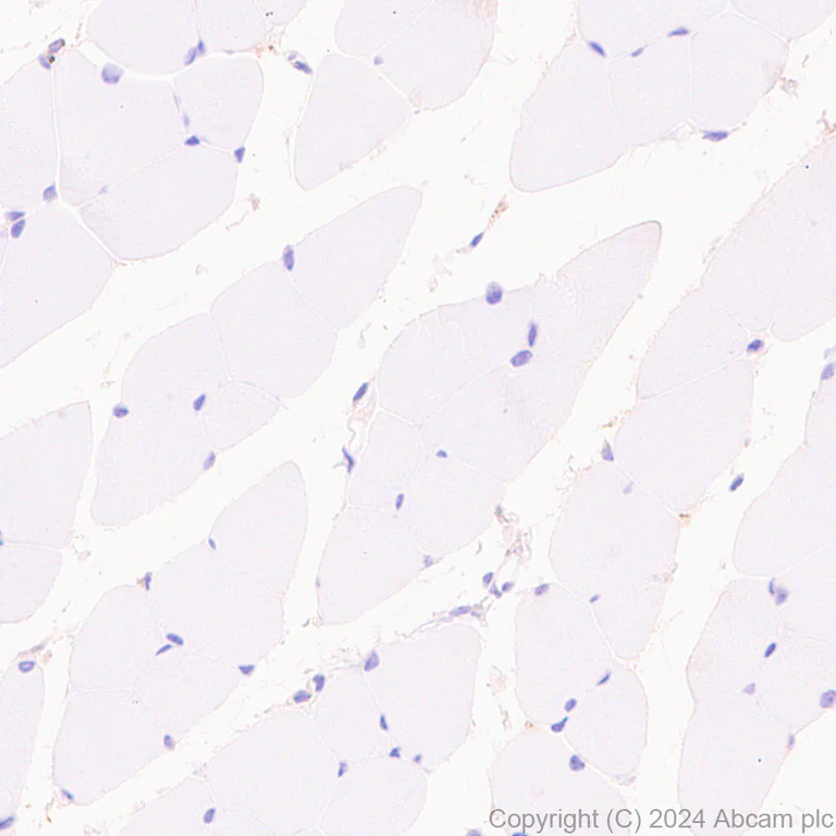 Immunohistochemistry (Formalin/PFA-fixed paraffin-embedded sections) - Anti-Transferrin antibody [RM2060] - Serum Loading Control (AB318997)
