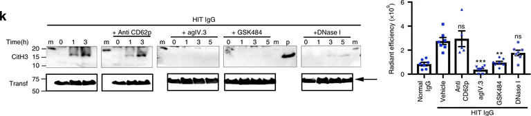 Western blot - Anti-Transferrin antibody - Serum Loading Control (AB82411)