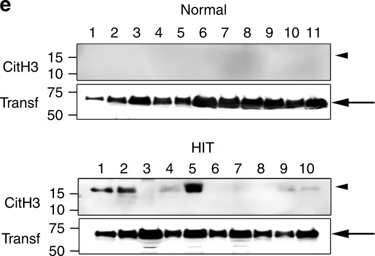Western blot - Anti-Transferrin antibody - Serum Loading Control (AB82411)
