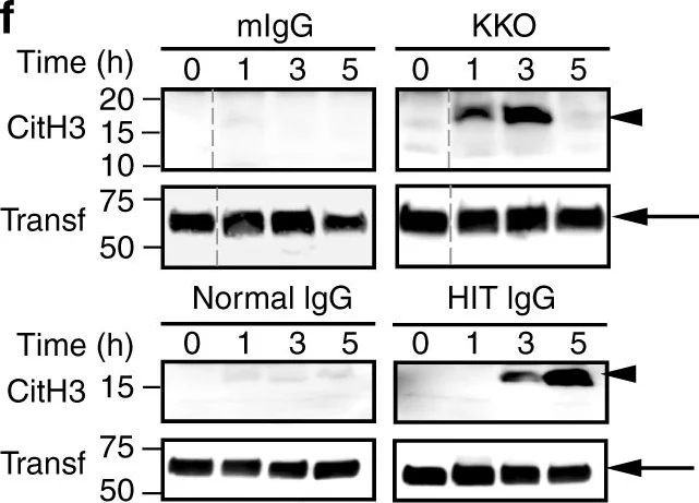 Western blot - Anti-Transferrin antibody - Serum Loading Control (AB82411)