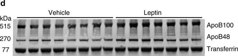 Western blot - Anti-Transferrin antibody - Serum Loading Control (AB82411)