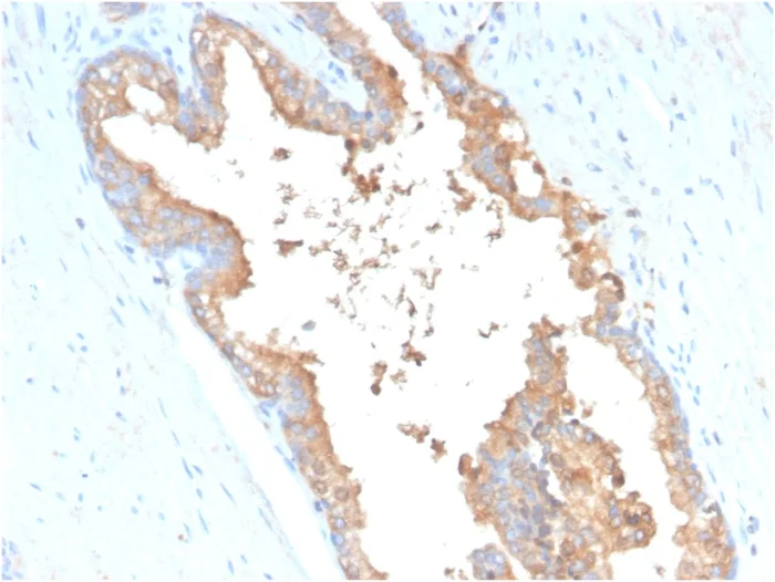 Immunohistochemistry (Formalin/PFA-fixed paraffin-embedded sections) - Anti-Transferrin antibody [TF/3001] (AB268117)