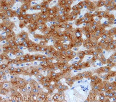 Immunohistochemistry (Formalin/PFA-fixed paraffin-embedded sections) - Anti-Transferrin Receptor 2/TFR2 antibody (AB80194)