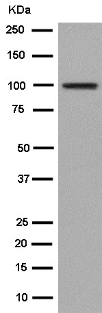 Western blot - Anti-Transferrin Receptor 2/TFR2 antibody [EPR15322] - BSA and Azide free (AB250837), expandable thumbnail