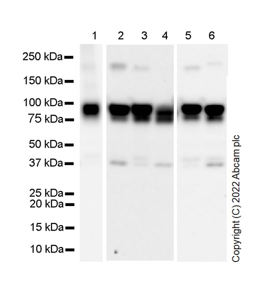 Western blot - Anti-Transferrin Receptor antibody [2/Transferrin] (AB300657), expandable thumbnail