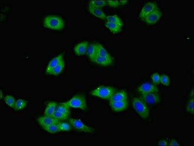 Immunocytochemistry/ Immunofluorescence - Anti-Transferrin Receptor antibody (AB193188), expandable thumbnail