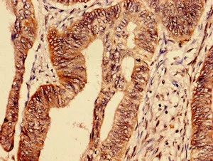 Immunohistochemistry (Formalin/PFA-fixed paraffin-embedded sections) - Anti-Transferrin Receptor antibody (AB193188)