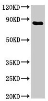 Western blot - Anti-Transferrin Receptor antibody (AB193188), expandable thumbnail
