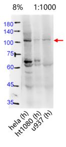 Western blot - Anti-Transferrin Receptor antibody (AB216665), expandable thumbnail