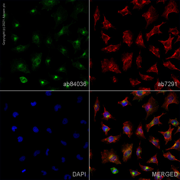 Immunocytochemistry/ Immunofluorescence - Anti-Transferrin Receptor antibody (AB84036), expandable thumbnail