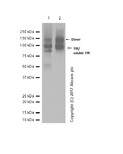 Western blot - Anti-Transferrin Receptor antibody [EPR20584] (ab214039), expandable thumbnail