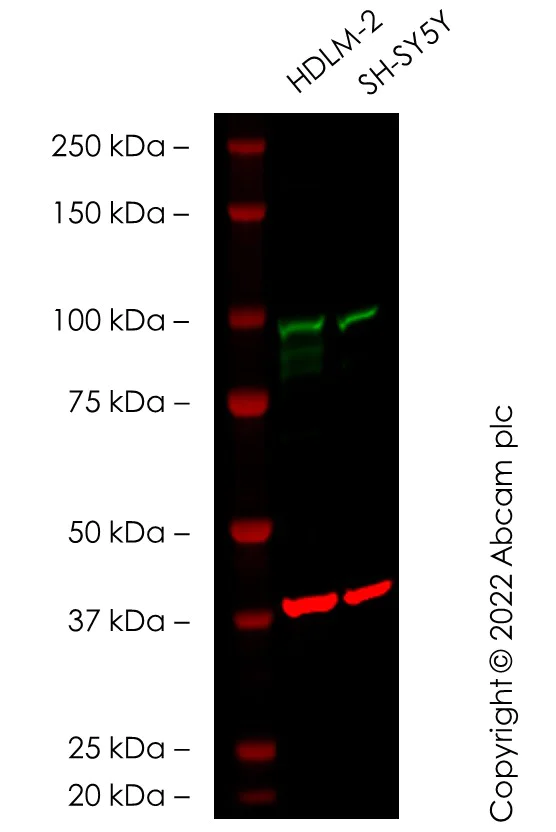 Western blot - Anti-Transferrin Receptor antibody [EPR20584] (AB214039)