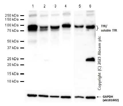 Western blot - Anti-Transferrin Receptor antibody [EPR20584] - BSA and Azide free (AB232376)