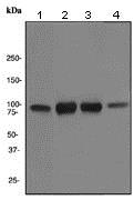 Western blot - Anti-Transferrin Receptor antibody [EPR4012] (AB108985), expandable thumbnail