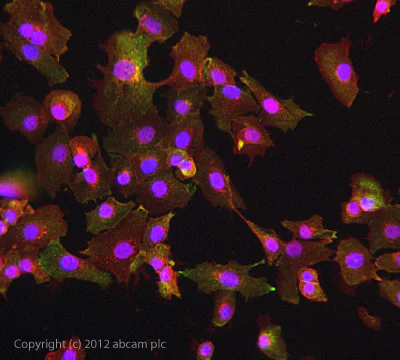 Immunocytochemistry - Anti-Transferrin Receptor antibody [MEM-75] (AB9179)