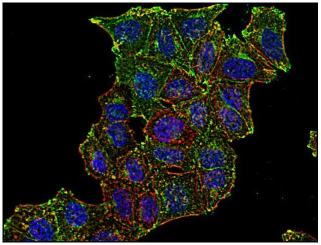 Immunocytochemistry/ Immunofluorescence - Anti-Transferrin Receptor antibody [MEM-75] (AB9179), expandable thumbnail