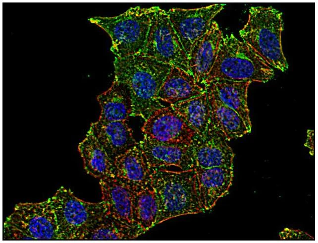 Immunocytochemistry/ Immunofluorescence - Anti-Transferrin Receptor antibody [MEM-75] (AB9179)