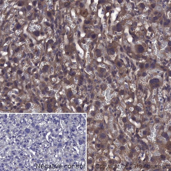 Immunohistochemistry (Formalin/PFA-fixed paraffin-embedded sections) - Anti-Transferrin Receptor antibody [OX26] (AB6331)