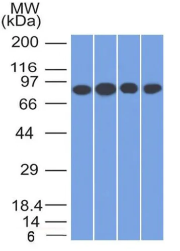 Western blot - Anti-Transferrin Receptor antibody [TFRC/1817] - BSA and Azide free (AB269756)