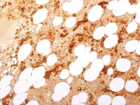 Immunohistochemistry (Formalin/PFA-fixed paraffin-embedded sections) - Anti-Transferrin Receptor antibody [TFRC/1818] - BSA and Azide free (AB269745)