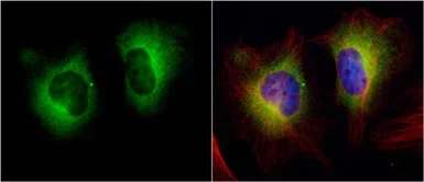 Immunocytochemistry/ Immunofluorescence - Anti-Transglutaminase 2 antibody (AB137378)