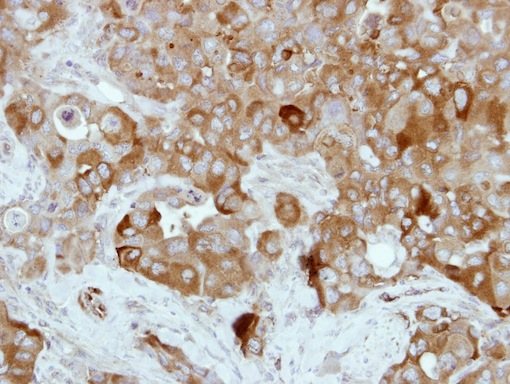 Immunohistochemistry (Formalin/PFA-fixed paraffin-embedded sections) - Anti-Transglutaminase 2 antibody (AB137378)