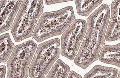 Immunohistochemistry (Formalin/PFA-fixed paraffin-embedded sections) - Anti-Transglutaminase 2 antibody (AB137378)