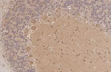 Immunohistochemistry (Formalin/PFA-fixed paraffin-embedded sections) - Anti-Transglutaminase 2 antibody (AB137378)