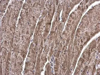 Immunohistochemistry (Formalin/PFA-fixed paraffin-embedded sections) - Anti-Transglutaminase 2 antibody (AB137378)