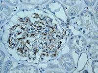 Immunohistochemistry (Formalin/PFA-fixed paraffin-embedded sections) - Anti-Transglutaminase 2 antibody [EP2957] (AB109200), expandable thumbnail
