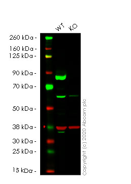 Western blot - Anti-Transglutaminase 2 antibody [EP2957] (AB109200), expandable thumbnail