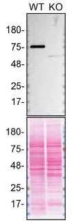 Western blot - Anti-Transglutaminase 2 antibody [EP2957] (AB109200)