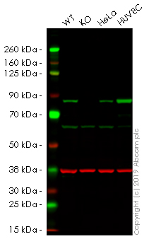 Western blot - Anti-Transglutaminase 2 antibody [EP2957] (AB109200), expandable thumbnail