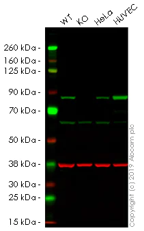 Western blot - Anti-Transglutaminase 2 antibody [EP2957] (AB109200)