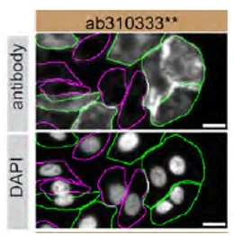Immunocytochemistry/ Immunofluorescence - Anti-Transglutaminase 2 antibody [EPR28142-86] (AB310333)