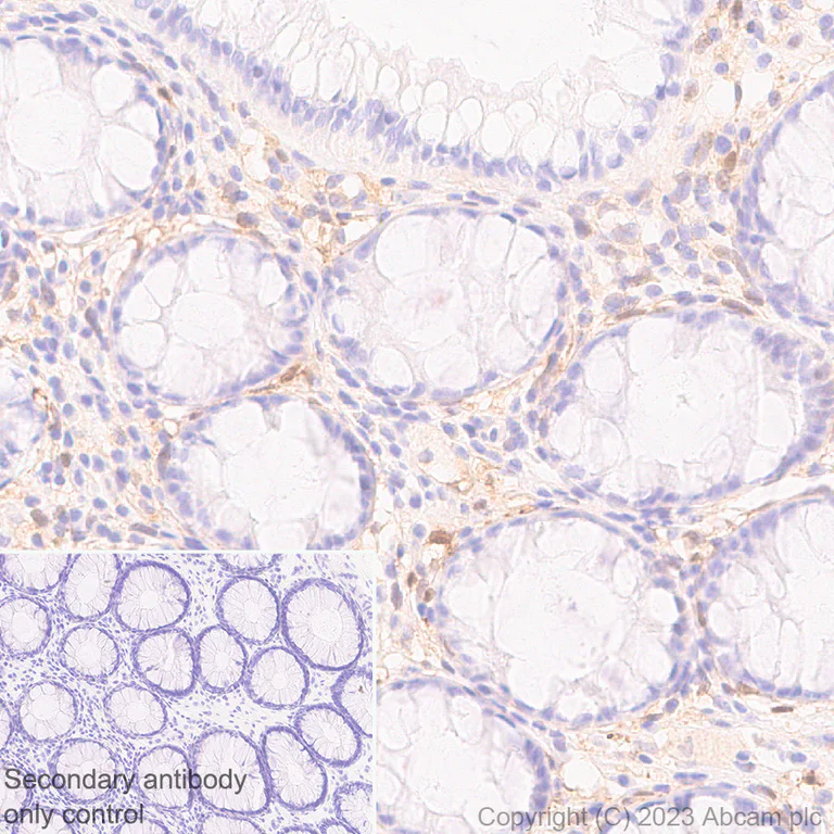Immunohistochemistry (Formalin/PFA-fixed paraffin-embedded sections) - Anti-Transglutaminase 2 antibody [EPR28142-86] - BSA and Azide free (AB310334)