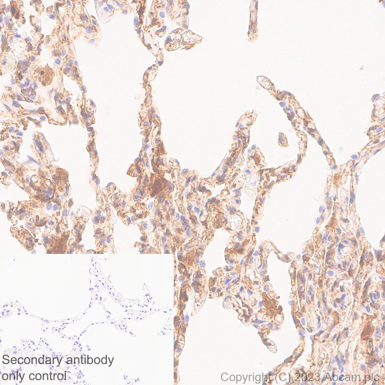 Immunohistochemistry (Formalin/PFA-fixed paraffin-embedded sections) - Anti-Transglutaminase 2 antibody [EPR28142-86] - BSA and Azide free (AB310334)
