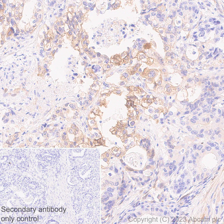Immunohistochemistry (Formalin/PFA-fixed paraffin-embedded sections) - Anti-Transglutaminase 2 antibody [EPR28142-86] - BSA and Azide free (AB310334)