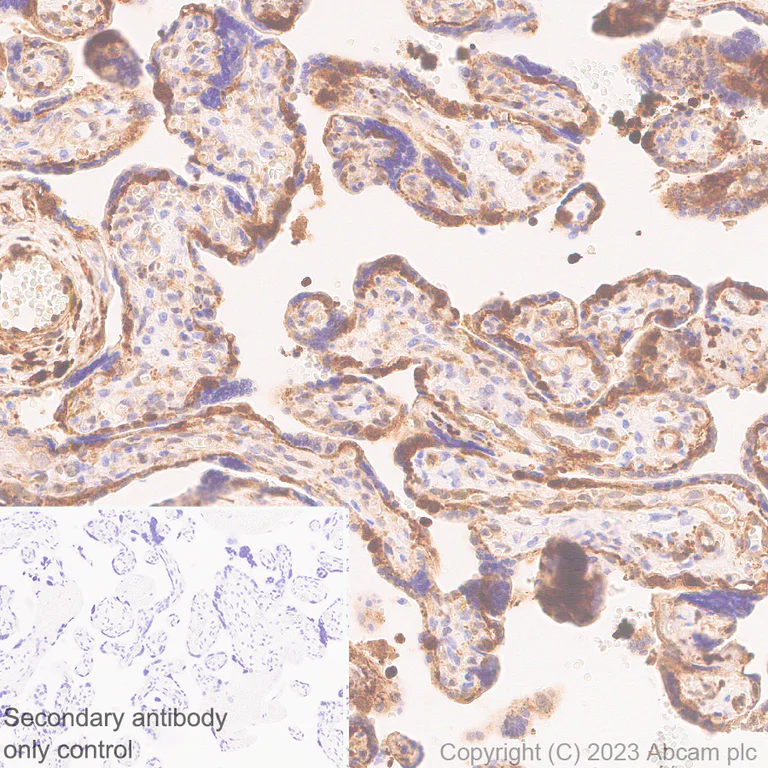 Immunohistochemistry (Formalin/PFA-fixed paraffin-embedded sections) - Anti-Transglutaminase 2 antibody [EPR28142-86] - BSA and Azide free (AB310334)