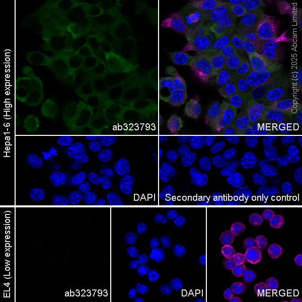 Immunocytochemistry/ Immunofluorescence - Anti-Transglutaminase 2 antibody [EPR29853-527] - BSA and Azide free (AB323809)