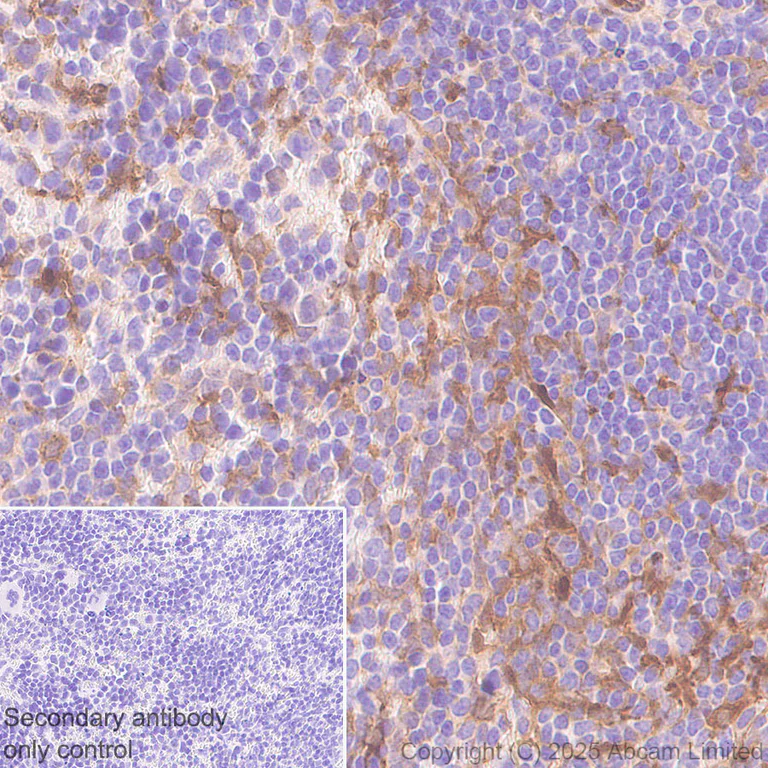 Immunohistochemistry (Formalin/PFA-fixed paraffin-embedded sections) - Anti-Transglutaminase 2 antibody [EPR29853-527] - BSA and Azide free (AB323809)