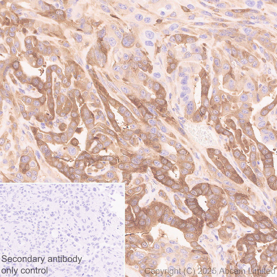 Immunohistochemistry (Formalin/PFA-fixed paraffin-embedded sections) - Anti-Transglutaminase 2 antibody [EPR29853-527]  - BSA and Azide free (ab323809), expandable thumbnail