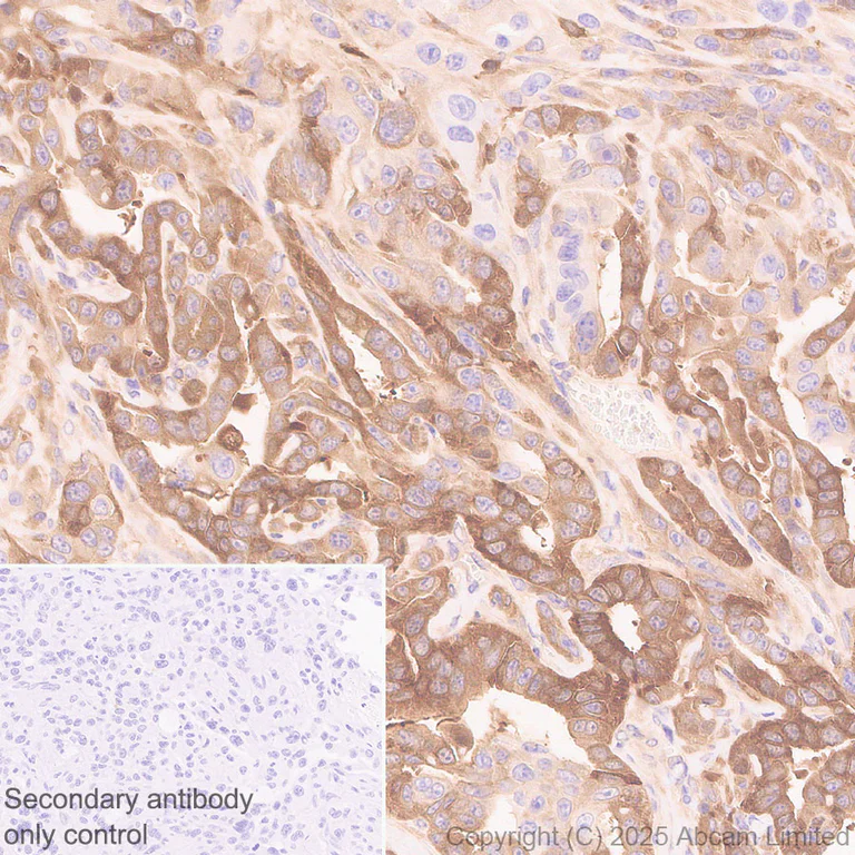 Immunohistochemistry (Formalin/PFA-fixed paraffin-embedded sections) - Anti-Transglutaminase 2 antibody [EPR29853-527] - BSA and Azide free (AB323809)