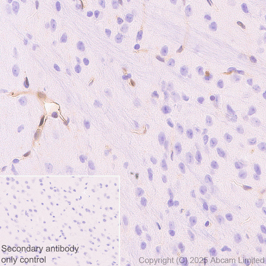Immunohistochemistry (Formalin/PFA-fixed paraffin-embedded sections) - Anti-Transglutaminase 2 antibody [EPR29853-527]  - BSA and Azide free (AB323809), expandable thumbnail