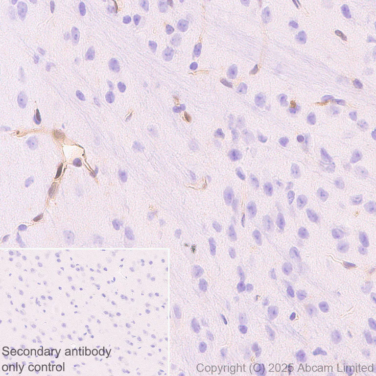 Immunohistochemistry (Formalin/PFA-fixed paraffin-embedded sections) - Anti-Transglutaminase 2 antibody [EPR29853-527] - BSA and Azide free (AB323809)