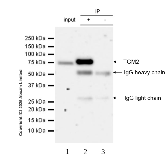 Immunoprecipitation - Anti-Transglutaminase 2 antibody [EPR29853-527]  - BSA and Azide free (ab323809), expandable thumbnail
