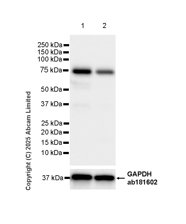 Western blot - Anti-Transglutaminase 2 antibody [EPR29853-527]  - BSA and Azide free (AB323809), expandable thumbnail