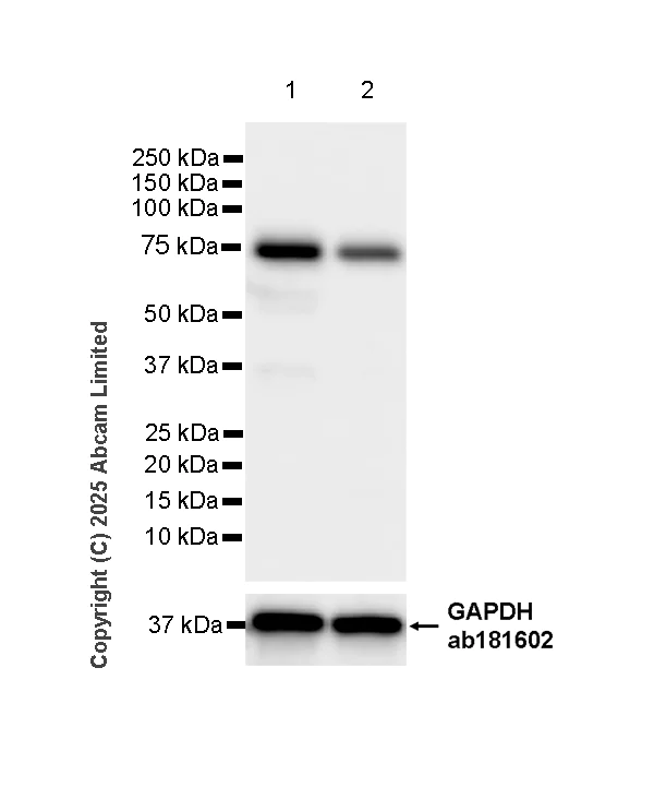 Western blot - Anti-Transglutaminase 2 antibody [EPR29853-527] - BSA and Azide free (AB323809)